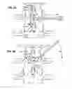 Fig. 06 - Systems and methods for in situ assembly of an interspinous process distraction implant