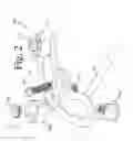 Fig. 03 - OCCIPITAL FIXATION SYSTEM AND METHOD OF USE