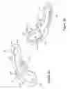 Fig. 04 - OCCIPITAL FIXATION SYSTEM AND METHOD OF USE