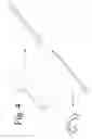 Fig. 05 - OCCIPITAL FIXATION SYSTEM AND METHOD OF USE