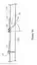 Fig. 06 - OCCIPITAL FIXATION SYSTEM AND METHOD OF USE