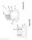 Fig. 13 - OCCIPITAL FIXATION SYSTEM AND METHOD OF USE