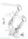 Fig. 34 - OCCIPITAL FIXATION SYSTEM AND METHOD OF USE