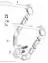 Fig. 35 - OCCIPITAL FIXATION SYSTEM AND METHOD OF USE