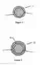 Fig. 02 - Enhanced Interfacial Conformance for a Composite Rod for Spinal Implant Systems with Higher Modulus Core and Lower Modulus Polymeric Sleeve