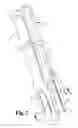 Fig. 04 - Low Profile Extension Attachments for Bone Anchors