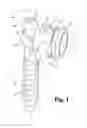 Fig. 02 - Spinal connector assembly
