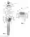 Fig. 03 - Vertebral column implant for stabilization and stiffening of vertebral bodies of a vertebral column