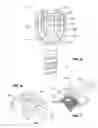 Fig. 05 - Vertebral column implant for stabilization and stiffening of vertebral bodies of a vertebral column