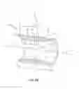 Fig. 06 - COLLAR BORE CONFIGURATION FOR DYNAMIC SPINAL STABILIZATION ASSEMBLY