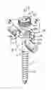 Fig. 01 - Threadform for medical implant closure