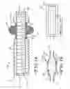 Fig. 05 - Removable anchoring pedicle screw