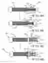 Fig. 06 - Removable anchoring pedicle screw