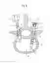 Fig. 03 - Bone anchoring device