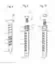 Fig. 05 - Bone anchoring device