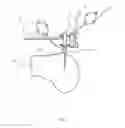 Fig. 03 - Reduced invasivity fixation system for trackers in computer assisted surgery