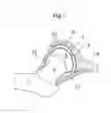 Fig. 02 - Hip joint instrument and method