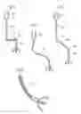 Fig. 15 - Hip joint instrument and method