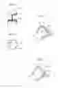 Fig. 31 - Hip joint instrument and method
