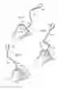 Fig. 32 - Hip joint instrument and method