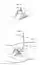 Fig. 33 - Hip joint instrument and method