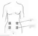 Fig. 01 - Portable combined stimulation device for alleviating menstrual pain