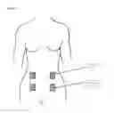 Fig. 04 - Portable combined stimulation device for alleviating menstrual pain