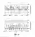 Fig. 16 - Supraventricular stimulation to control ventricular rate