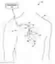 Fig. 01 - AUTOMATIC PERSONALIZATION OF PARAMETER SETTINGS AND ALGORITHMS IN A MEDICAL DEVICE