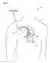 Fig. 02 - AUTOMATIC ADJUSTMENT OF ARRHYTHMIA DETECTION PARAMETERS