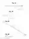 Fig. 04 - Implant tool and improved electrode design for minimally invasive procedure