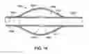 Fig. 10 - Refillable reservoir lead systems