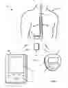 Fig. 02 - Impedance-based stimulation adjustment