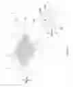 Fig. 08 - Retina Stimulation Apparatus and Manufacturing Method Thereof