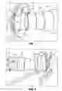 Fig. 06 - Patient warming system