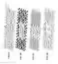 Fig. 02 - STENT WITH RADIALLY ASYMMETRIC FORCE DISTRIBUTION