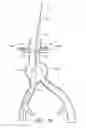 Fig. 16 - APPARATUS AND METHOD OF PLACEMENT OF A GRAFT OR GRAFT SYSTEM