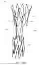 Fig. 23 - APPARATUS AND METHOD OF PLACEMENT OF A GRAFT OR GRAFT SYSTEM