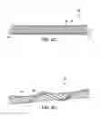 Fig. 05 - Torsion Constrained Stent Delivery System