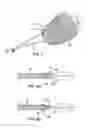 Fig. 09 - Torsion Constrained Stent Delivery System