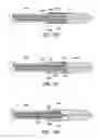 Fig. 14 - Torsion Constrained Stent Delivery System