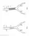 Fig. 03 - Energized stents and methods of using the same