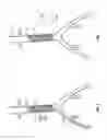 Fig. 05 - Energized stents and methods of using the same