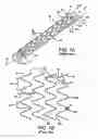 Fig. 02 - Stent having adjacent elements connected by flexible webs