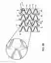 Fig. 04 - Stent having adjacent elements connected by flexible webs