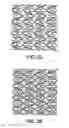 Fig. 05 - Stent having adjacent elements connected by flexible webs
