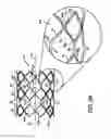Fig. 08 - Stent having adjacent elements connected by flexible webs