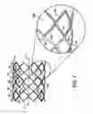 Fig. 11 - Stent having adjacent elements connected by flexible webs