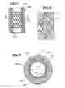 Fig. 03 - Method for mass transfer of micro-patterns onto medical devices