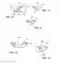 Fig. 06 - Method for mass transfer of micro-patterns onto medical devices